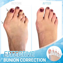 Load image into Gallery viewer, Dr.Fit Silicone Bunion Corrector
