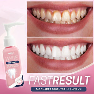SmileWhite™ Stain Removal Toothpaste