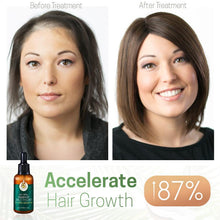 Load image into Gallery viewer, ReGrowth Hair Boost Serum
