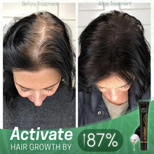 Load image into Gallery viewer, Regrowth™ Organic Hair Serum Roller
