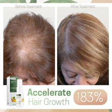 Load image into Gallery viewer, ReGrowth Nourishing Ginger Spray
