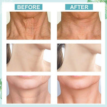 Load image into Gallery viewer, Anti-Wrinkle Neck Cream
