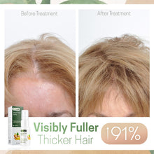 Load image into Gallery viewer, ReGrowth Nourishing Ginger Spray
