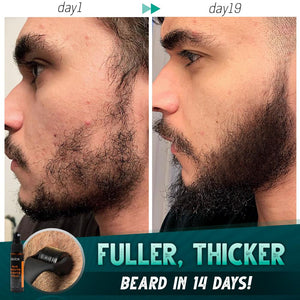 Beard Growth Nourishing Roller Set