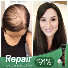 Load image into Gallery viewer, Regrowth™ Organic Hair Serum Roller
